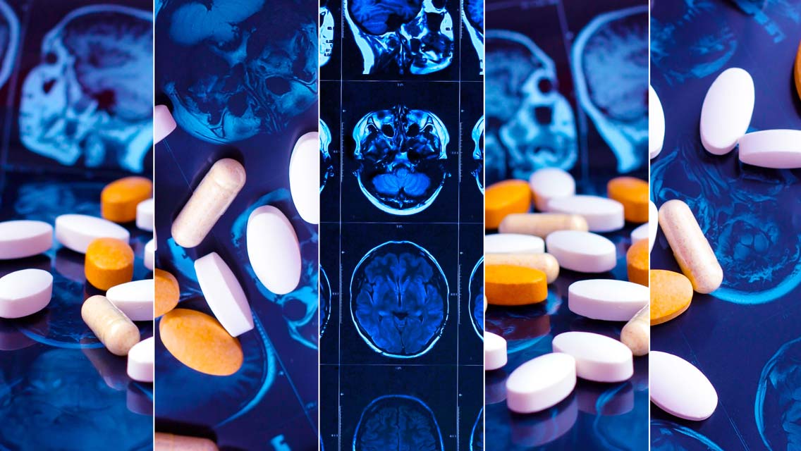 medical illustration.