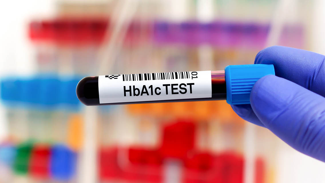 a test tube of blood